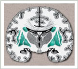 Brain Graphic