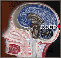 Coup