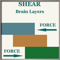 Shear Diagram